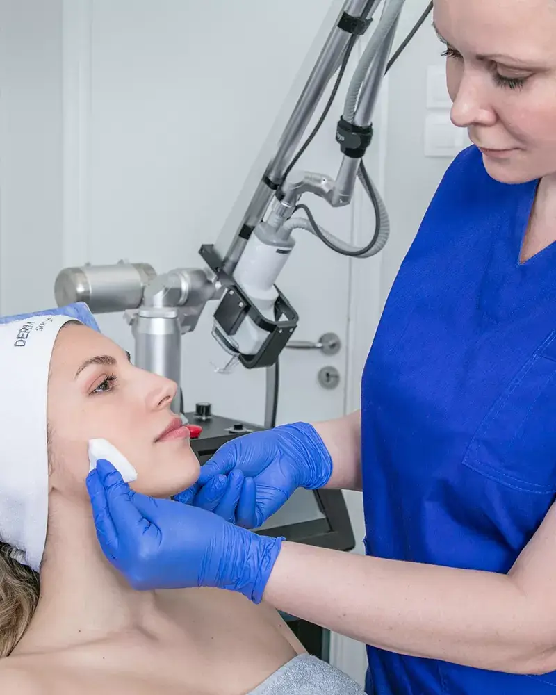 Fractional Laser Θεραπεία Καθαρισμός Προσώπου