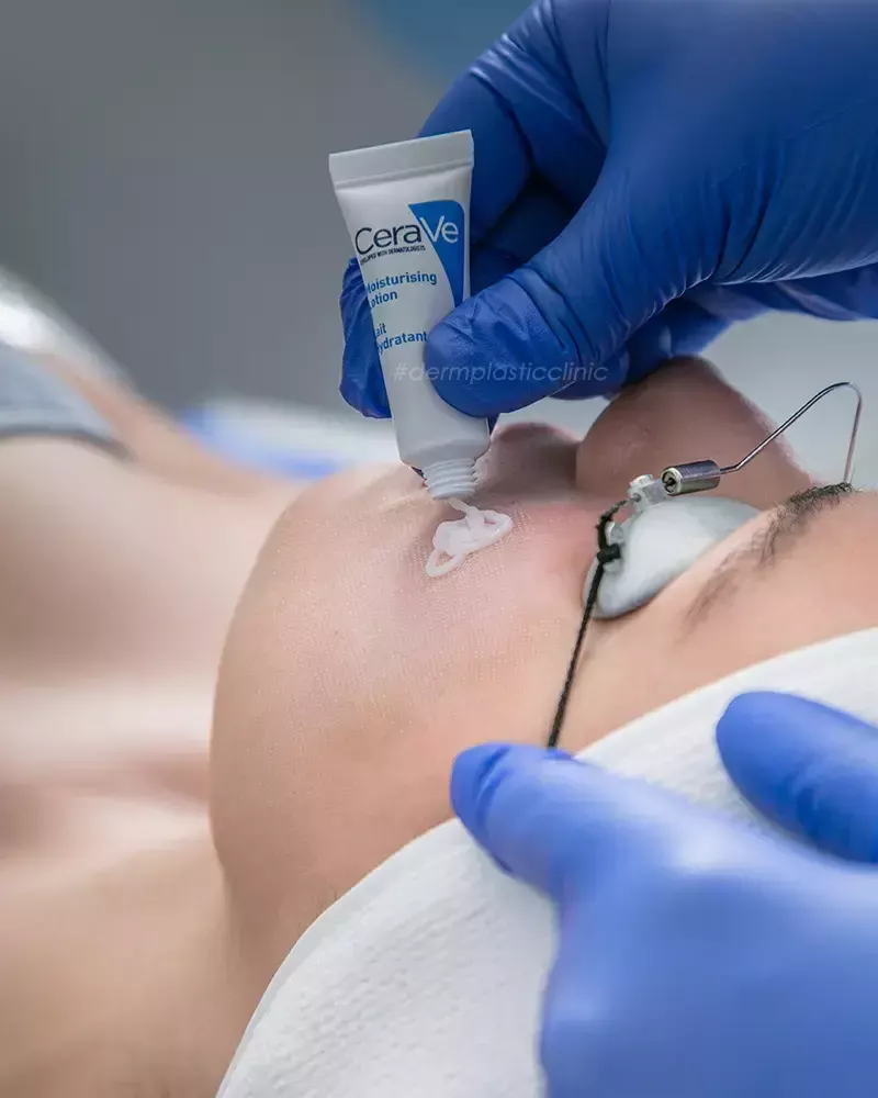 Εφαρμογή Κρέμας Μετά το Fractional Laser Προσώπου