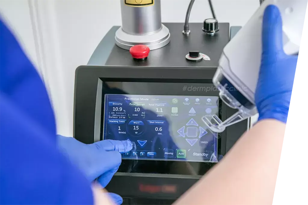 Γιατί να Επιλέξω Derm Plastic Clinic για Fractional Laser