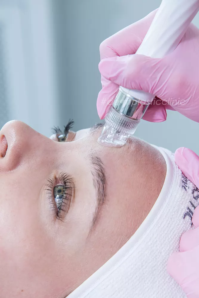 Πως Δρα το Hydrafacial