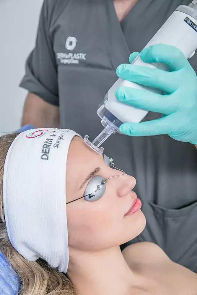 Τι είναι το Fractional Laser