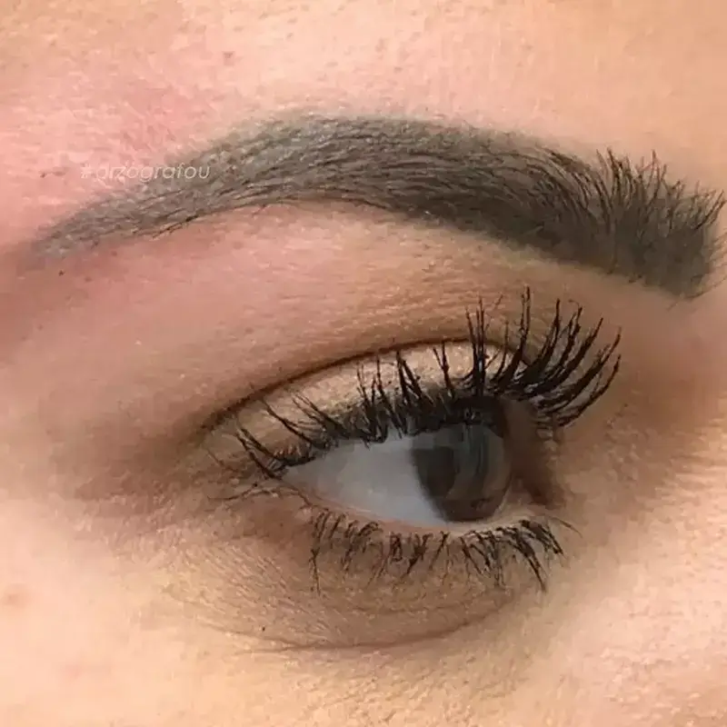 Cat Eyes Lift Φωτογραφία Μετά