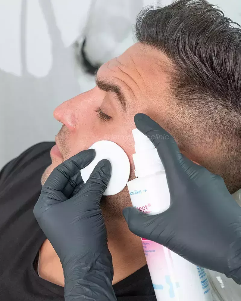 Προετοιμασία Δέρματος για Brotox